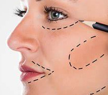 lifting facial cirurgia plástica em SP
