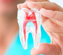 Endodontia Odontologia