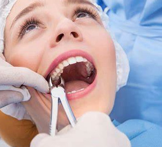 Extrações Dentárias clínica