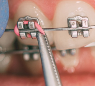 Ortodontia Odontologia clínica