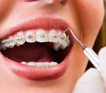 Ortodontia Odontologia