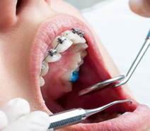 Ortodontia Odontologia em SP