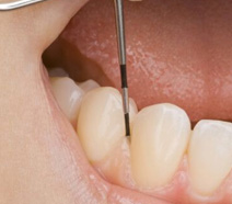periodontia Odontologia