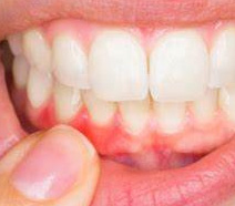 periodontia Odontologia em SP